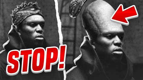 STOP WITH THE HAIRLINE MEMES .